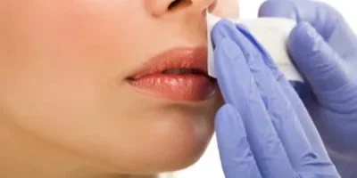 Lip Waxing Treatment