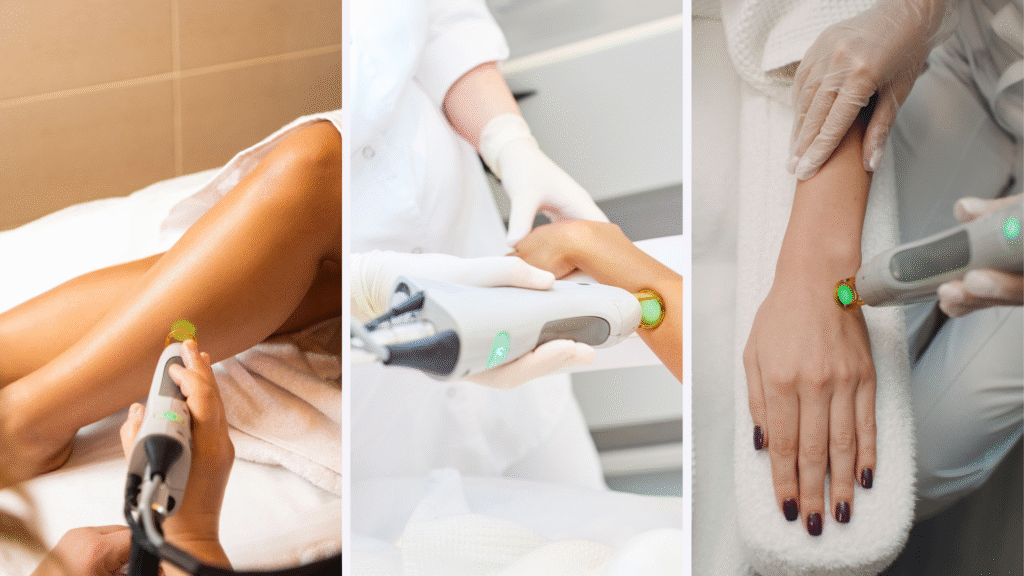 Best Laser Hair Removal