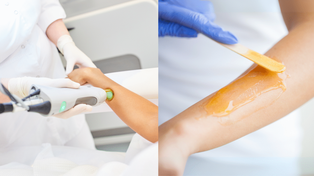 Laser Hair Removal or Waxing