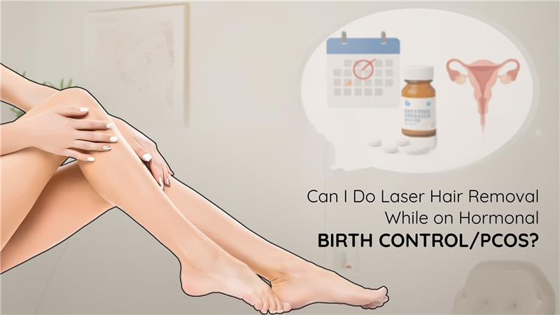 pcos and hormonal birth control